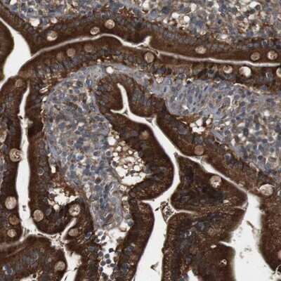 Immunohistochemistry-Paraffin: IFFO2 Antibody [NBP1-91092]