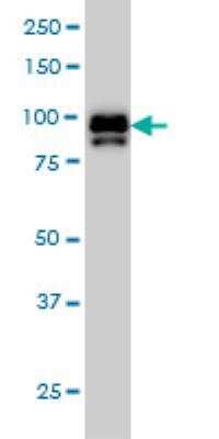 Western Blot: IFI16 Antibody (2E3) [H00003428-M03]