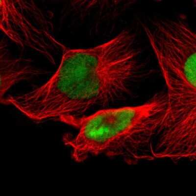 Immunocytochemistry/ Immunofluorescence: IFI16 Antibody [NBP1-83118]