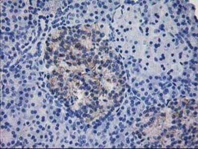 Immunohistochemistry-Paraffin: IFI35 Antibody (OTI1C9) [NBP2-01108]
