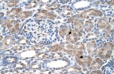 Immunohistochemistry-Paraffin: IFI44L Antibody [NBP1-57838]