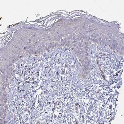 Immunohistochemistry-Paraffin: IFI44L Antibody [NBP2-38892]