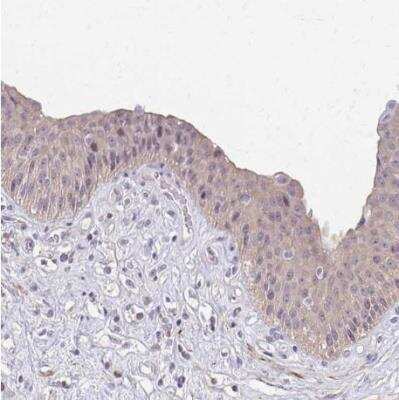 Immunohistochemistry-Paraffin: IFI44L Antibody [NBP2-38892]