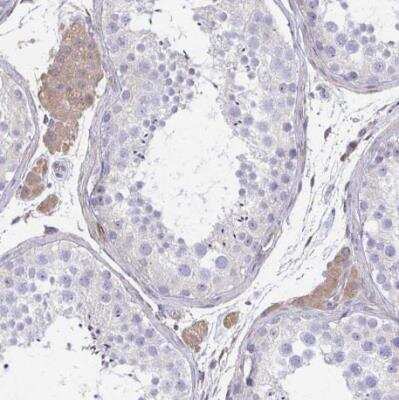 Immunohistochemistry-Paraffin: IFI44L Antibody [NBP2-38892]