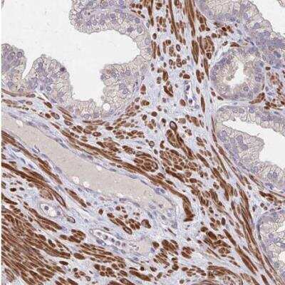 Immunohistochemistry-Paraffin: IFI44L Antibody [NBP2-38892]