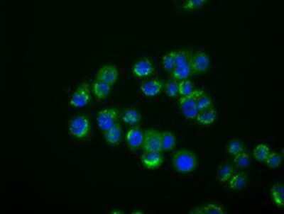 Immunocytochemistry/ Immunofluorescence: IFIT1 Antibody (OTI3G8) [NBP2-02340]