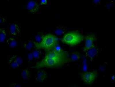 Immunocytochemistry/ Immunofluorescence: IFIT1 Antibody (OTI3G8) [NBP2-02340]