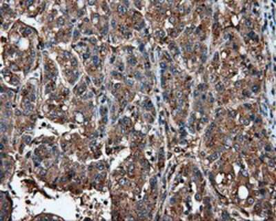 Immunohistochemistry-Paraffin: IFIT1 Antibody (OTI3G8) [NBP2-02340]
