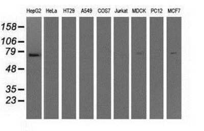 Western Blot: IFIT1 Antibody (OTI3G8) [NBP2-02340]