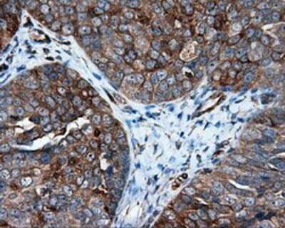 Immunohistochemistry: IFIT1 Antibody (OTI3G8) - Azide and BSA Free [NBP2-71005]