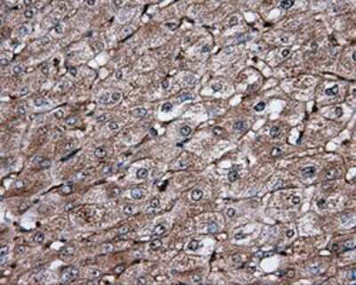 Immunohistochemistry: IFIT1 Antibody (OTI3G8) - Azide and BSA Free [NBP2-71005]