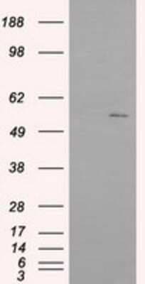 Western Blot: IFIT1 Antibody (OTI3G8)Azide and BSA Free [NBP2-71005]