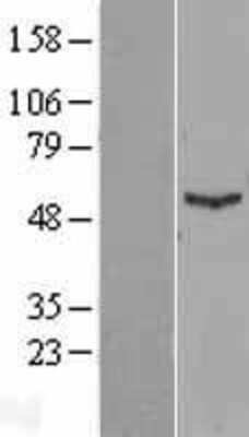 Western Blot: IFIT1 Overexpression Lysate [NBL1-11834]