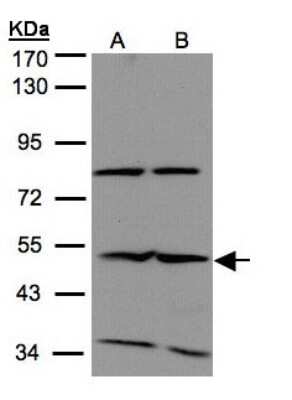 Western Blot: IFIT2 Antibody [NBP1-31164]
