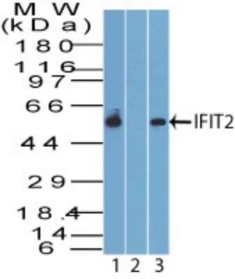 Western Blot: IFIT2 Antibody [NBP2-15180]