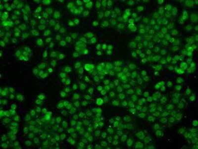 Immunocytochemistry/ Immunofluorescence: IFIT3 Antibody (OTI1G1) [NBP2-02148]