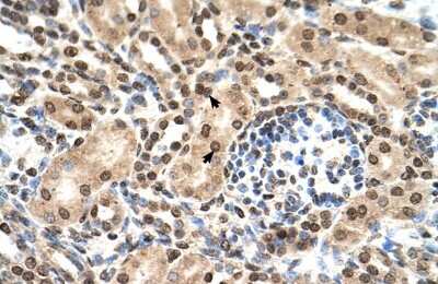 Immunohistochemistry-Paraffin: IFIT3 Antibody [NBP1-56632]