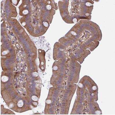 Immunohistochemistry-Paraffin: IFIT3 Antibody [NBP2-32500]