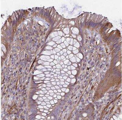Immunohistochemistry-Paraffin: IFIT3 Antibody [NBP2-32500]