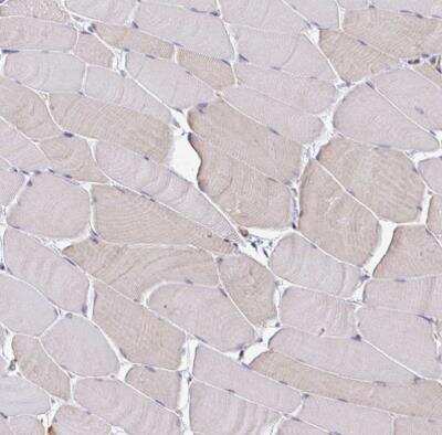 Immunohistochemistry-Paraffin: IFIT3 Antibody [NBP2-32500]