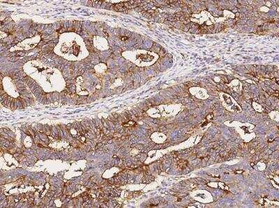 Immunohistochemistry-Paraffin: IFITM1 Antibody (001) [NBP2-89229]