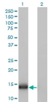 Western Blot: IFITM1 Antibody (1F8) [H00008519-M01]