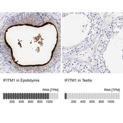 Immunohistochemistry-Paraffin: IFITM1 Antibody [NBP1-89345]