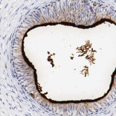 Immunohistochemistry-Paraffin: IFITM1 Antibody [NBP1-89345]