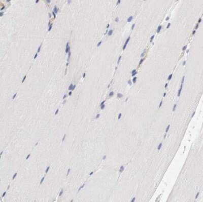 Immunohistochemistry-Paraffin: IFITM1 Antibody [NBP1-89345]