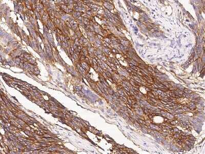 IFITM1 Antibody