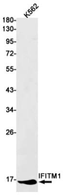 Western Blot: IFITM1 Antibody (S07-7F8) [NBP3-19659]