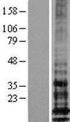 Western Blot: IFITM1 Overexpression Lysate [NBL1-11839]