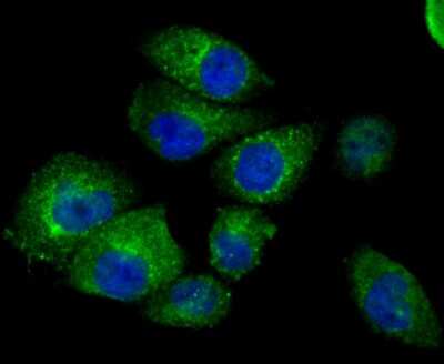 Immunocytochemistry/ Immunofluorescence: IFITM3/Fragilis Antibody (JU73-02) [NBP2-75533]