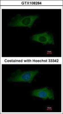 Immunocytochemistry/ Immunofluorescence: IFN-alpha 2 Antibody [NBP2-42866]
