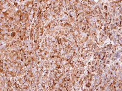 Immunohistochemistry-Paraffin: IFN-alpha 2 Antibody [NBP2-42866]