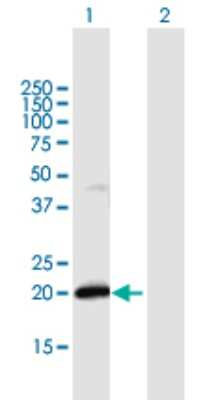 Western Blot: IFN-alpha F/IFNA21 Antibody [H00003452-B01P]
