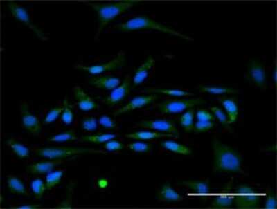 Immunocytochemistry/ Immunofluorescence: IFN-alpha I/IFNA17 Antibody [H00003451-D01P]