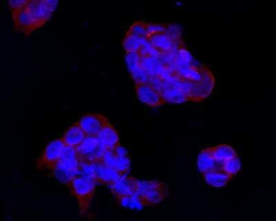 Immunocytochemistry/ Immunofluorescence: IFN-alpha/beta R1 Antibody (A5-A3) [NBP2-75534]