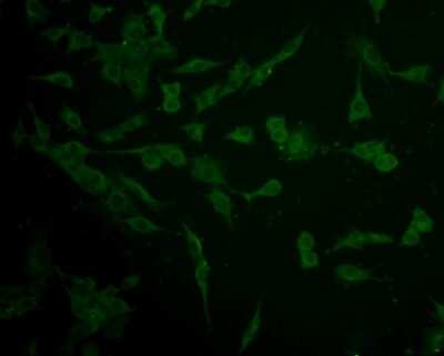 Immunocytochemistry/ Immunofluorescence: IFN-alpha/beta R1 Antibody (A5-A3) [NBP2-75534]
