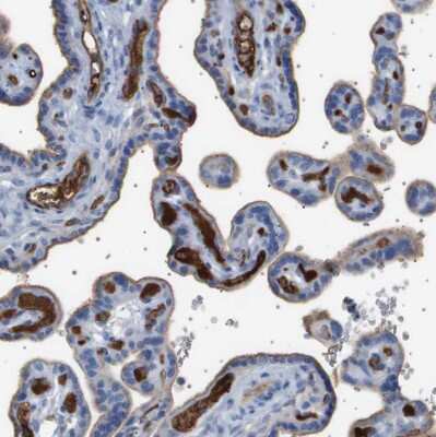 Immunohistochemistry-Paraffin: IFN-alpha/beta R1 Antibody [NBP1-83119]