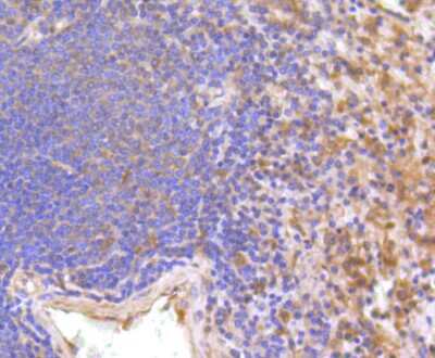 Immunohistochemistry-Paraffin: IFN-alpha/beta R1 Antibody (SR45-08) [NBP2-67339]