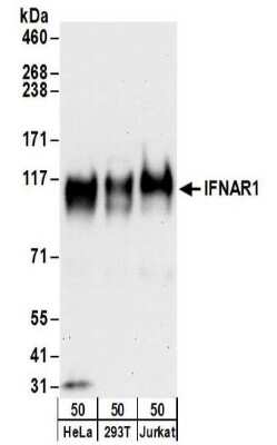 Western Blot: IFN-alpha/beta R1 Antibody [NBP2-32196]