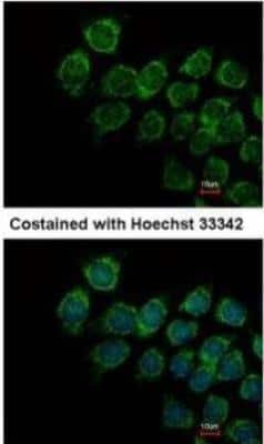 Immunocytochemistry/ Immunofluorescence: IFN-alpha/beta R2 Antibody [NBP1-31665]