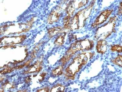 Immunohistochemistry-Paraffin: IFN-gamma Antibody (IFNG/466) - Azide and BSA Free [NBP2-54394]