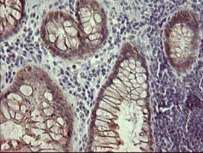 Immunohistochemistry: IFN-gamma R2 Antibody (OTI1C2) [NBP2-46031]