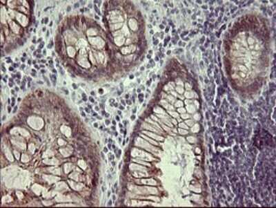 Immunohistochemistry: IFN-gamma R2 Antibody (OTI1C2) - Azide and BSA Free [NBP2-71008]