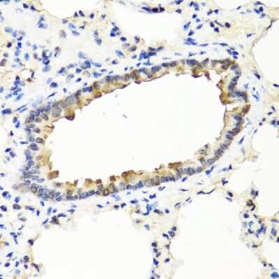 Immunohistochemistry-Paraffin: IFN-omega/IFNW1 Antibody - BSA Free [NBP3-03585]