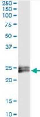Immunoprecipitation: IFN-epsilon Antibody (3B8) [H00338376-M01]