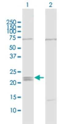 Western Blot: IFN-epsilon Antibody [H00338376-D01P]