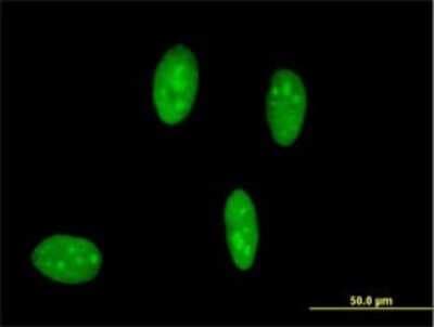 Immunocytochemistry/ Immunofluorescence: IFNR Antibody (2C5) [H00003466-M01]